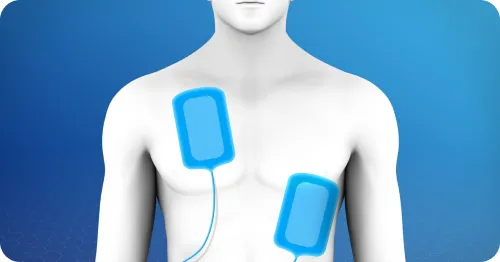 Electrical cardioversion